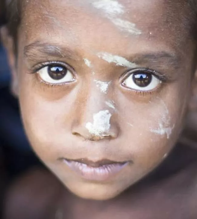 acnur rohingya child